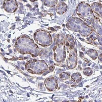 Immunohistochemistry: SLC35B1 Antibody [NBP2-31677]