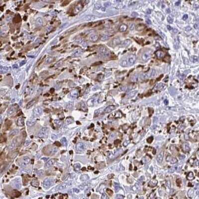 Immunohistochemistry: SLC35B1 Antibody [NBP2-31677]