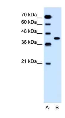 Western Blot: SLC35B1 Antibody [NBP1-62266]