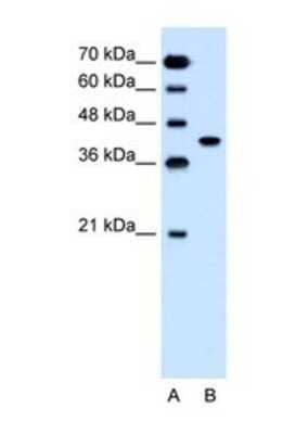 Western Blot: SLC35B1 Antibody [NBP1-69299]