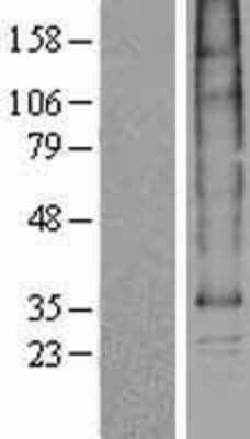 Western Blot: SLC35B1 Overexpression Lysate [NBP2-04301]