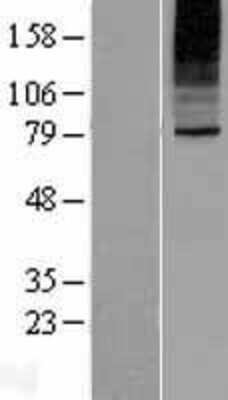 Western Blot: SLC35B2 Overexpression Lysate [NBP2-04970]