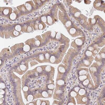 Immunohistochemistry: SLC35B3 Antibody [NBP2-37943]