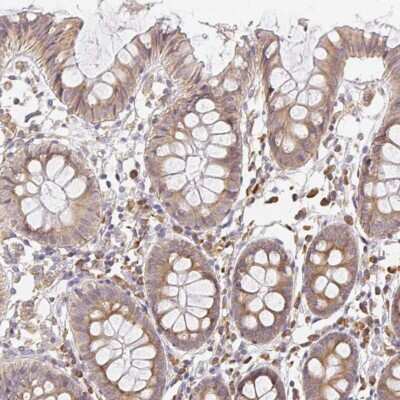 Immunohistochemistry: SLC35B3 Antibody [NBP2-37965]