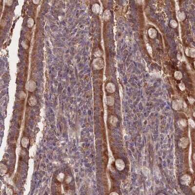 Immunohistochemistry-Paraffin: SLC35B4 Antibody [NBP2-13329]