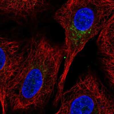 Immunocytochemistry/ Immunofluorescence: SLC35C1 Antibody [NBP2-49410]