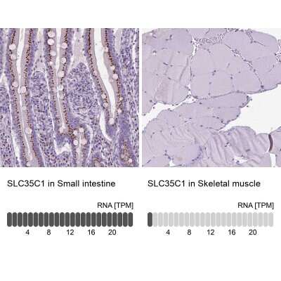 Immunohistochemistry-Paraffin: SLC35C1 Antibody [NBP2-49410]