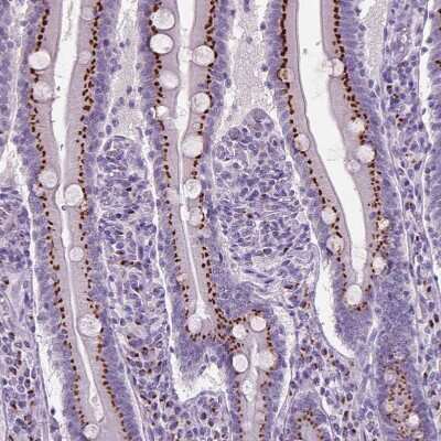 Immunohistochemistry-Paraffin: SLC35C1 Antibody [NBP2-49410]