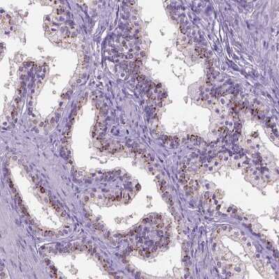 Immunohistochemistry-Paraffin: SLC35C1 Antibody [NBP2-49410]