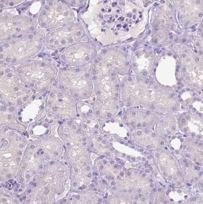 Immunohistochemistry-Paraffin: SLC35C1 Antibody [NBP2-49410]