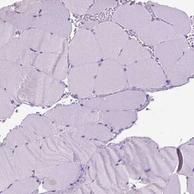 Immunohistochemistry-Paraffin: SLC35C1 Antibody [NBP2-49410]