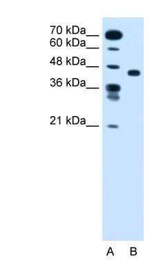 Western Blot: SLC35C1 Antibody [NBP1-59386]