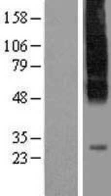 Western Blot: SLC35C1 Overexpression Lysate [NBP2-06810]