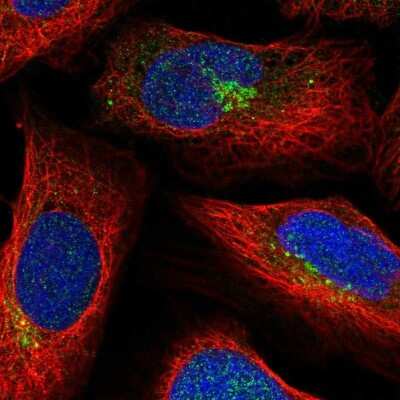 Immunocytochemistry/ Immunofluorescence: SLC35C2 Antibody [NBP2-32008]