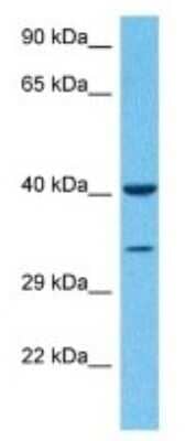 Western Blot: SLC35D1 Antibody [NBP3-09954]