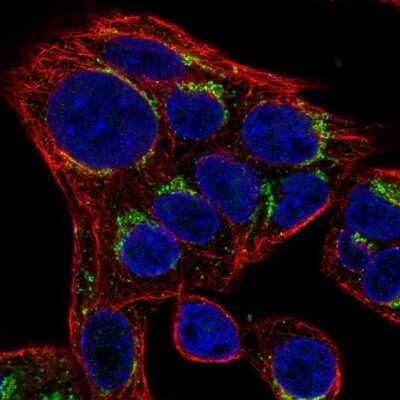 Immunocytochemistry/ Immunofluorescence: SLC35D2 Antibody [NBP2-38040]