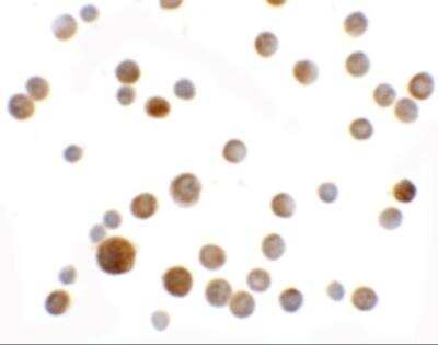 Immunocytochemistry/ Immunofluorescence: SLC35D2 Antibody - BSA Free [NBP2-81806]