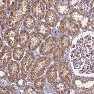 Immunohistochemistry: SLC35D2 Antibody [NBP2-38040]