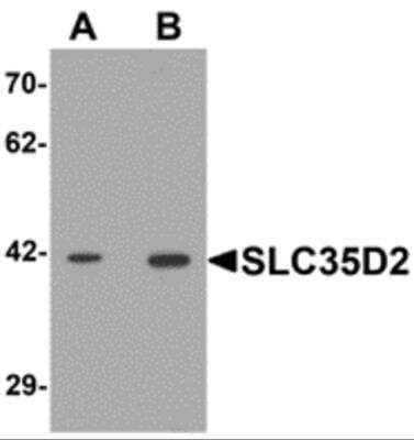 Western Blot: SLC35D2 AntibodyBSA Free [NBP2-81806]