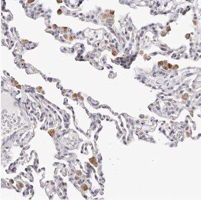 Immunohistochemistry-Paraffin: SLC35D3 Antibody [NBP1-81867]