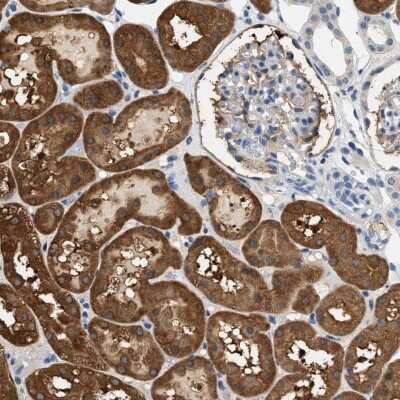 Immunohistochemistry-Paraffin: SLC35E1 Antibody [NBP1-94009]