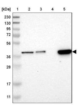 Western Blot: SLC35E1 Antibody [NBP1-94009]