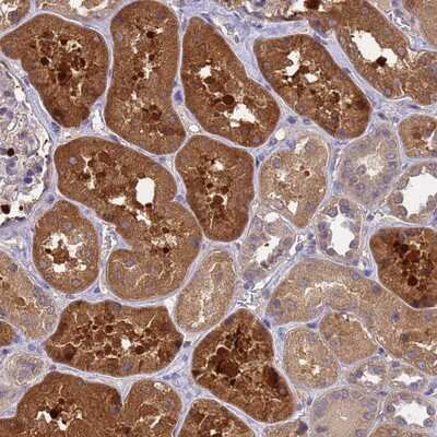 Immunohistochemistry-Paraffin: SLC35E2B Antibody [NBP2-14551]