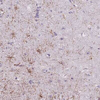 Immunohistochemistry-Paraffin: SLC35E3 Antibody [NBP2-33563]