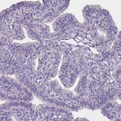Immunohistochemistry: SLC35E4 Antibody [NBP2-13330]