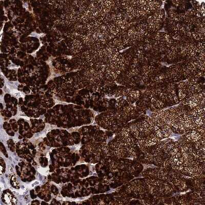 Immunohistochemistry-Paraffin: SLC35E4 Antibody [NBP2-13330]
