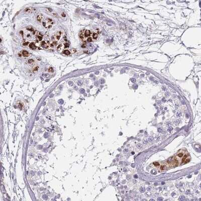 Immunohistochemistry-Paraffin: SLC35E4 Antibody [NBP2-13330]