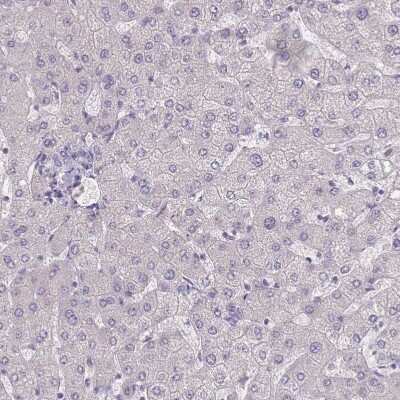 Immunohistochemistry-Paraffin: SLC35E4 Antibody [NBP2-13330]