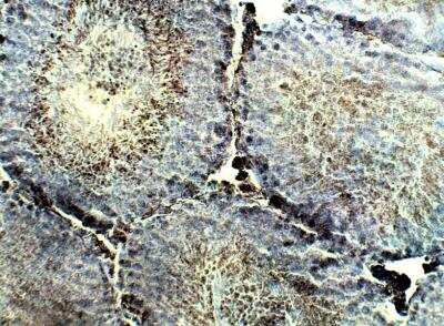Immunohistochemistry-Paraffin: SLC35E4 Antibody [NBP3-12349]