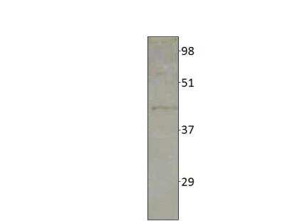 Western Blot: SLC35E4 Antibody [NBP3-12349]