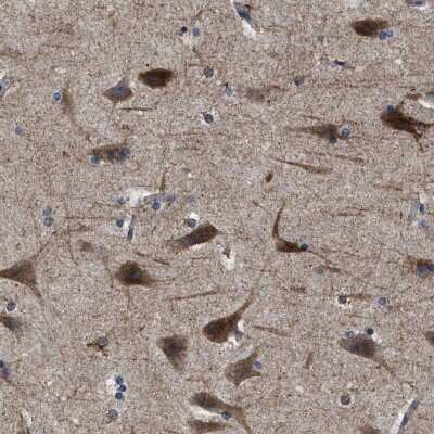 Immunohistochemistry-Paraffin: SLC35F1 Antibody [NBP1-86755]