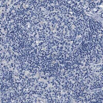 Immunohistochemistry-Paraffin: SLC35F1 Antibody [NBP1-86755]