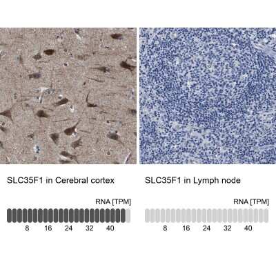 Immunohistochemistry-Paraffin: SLC35F1 Antibody [NBP1-86755]