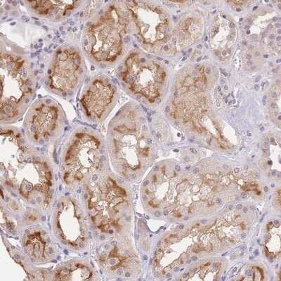 Immunohistochemistry-Paraffin: SLC35F2 Antibody [NBP2-13331]