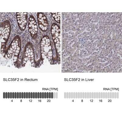 Immunohistochemistry-Paraffin: SLC35F2 Antibody [NBP3-17115]