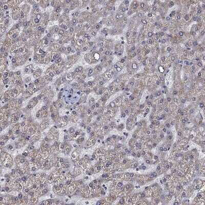 Immunohistochemistry-Paraffin: SLC35F2 Antibody [NBP3-17115]