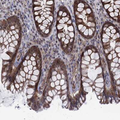 Immunohistochemistry-Paraffin: SLC35F2 Antibody [NBP3-17115]