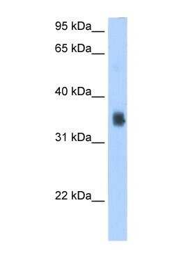 Western Blot: SLC35F2 Antibody [NBP1-59890]