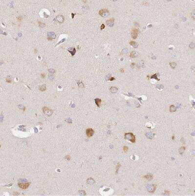 Immunohistochemistry-Paraffin: SLC35F3 Antibody [NBP2-13332]