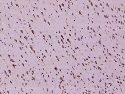 Immunohistochemistry-Paraffin: SLC35F6 Antibody [NBP2-98133]