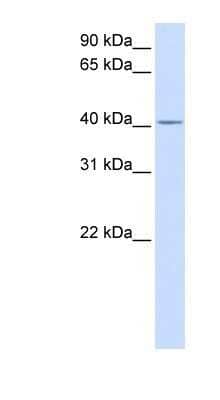 Western Blot: SLC35F6 Antibody [NBP1-91306]