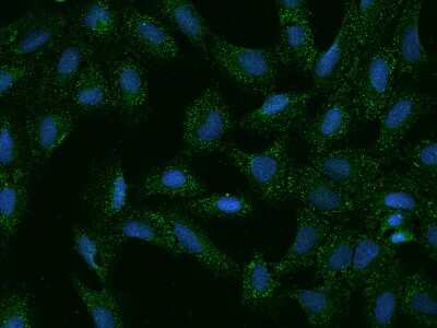 Immunocytochemistry/ Immunofluorescence: SLC35G2 Antibody [NBP2-97661]