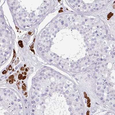 Immunohistochemistry-Paraffin: SLC35G2 Antibody [NBP2-14756]