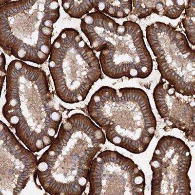 Immunohistochemistry-Paraffin: SLC36A1 Antibody [NBP1-81280]