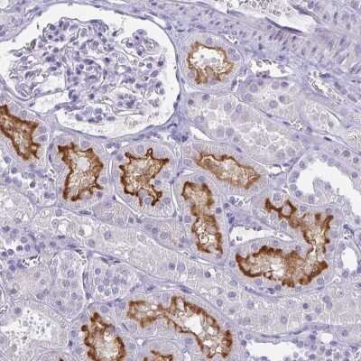 Immunohistochemistry: SLC36A2 Antibody [NBP2-49360]