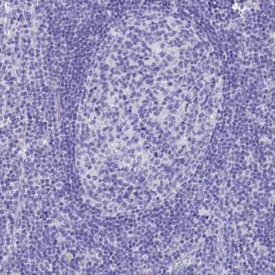 Immunohistochemistry-Paraffin: SLC36A2 Antibody [NBP1-92401]
